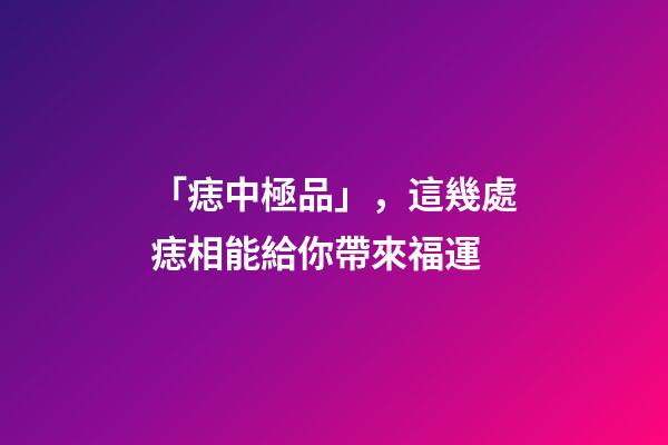 「痣中極品」，這幾處痣相能給你帶來福運