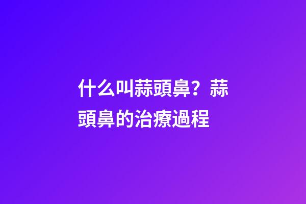 什么叫蒜頭鼻？蒜頭鼻的治療過程
