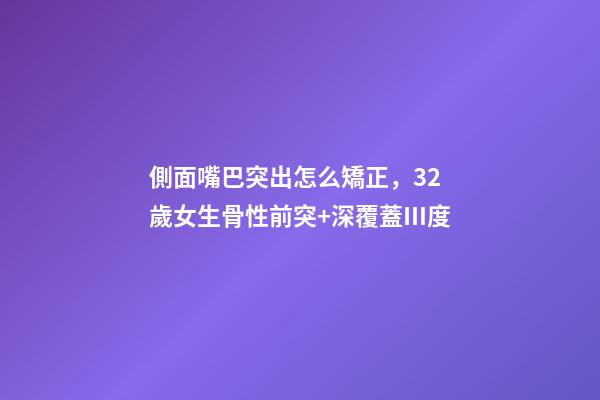 側面嘴巴突出怎么矯正，32歲女生骨性前突+深覆蓋Ⅲ度-第1張-觀點-玄機派
