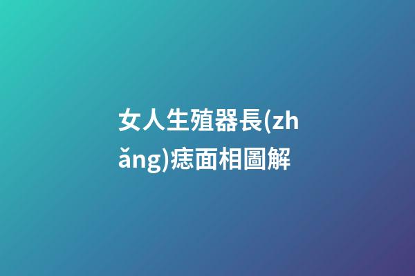 女人生殖器長(zhǎng)痣面相圖解