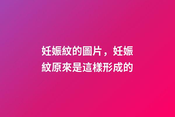妊娠紋的圖片，妊娠紋原來是這樣形成的-第1張-觀點-玄機派
