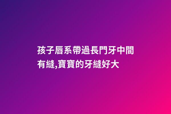 孩子唇系帶過長門牙中間有縫,寶寶的牙縫好大-第1張-觀點-玄機派