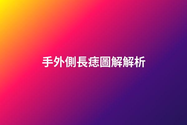 手外側長痣圖解解析