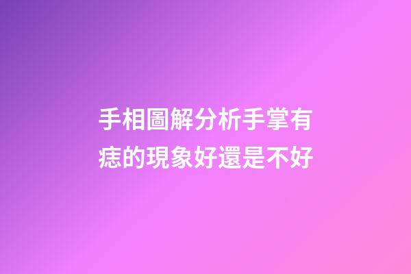 手相圖解分析手掌有痣的現象好還是不好