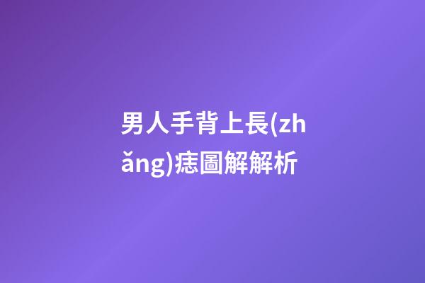 男人手背上長(zhǎng)痣圖解解析