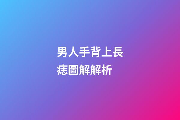 男人手背上長痣圖解解析