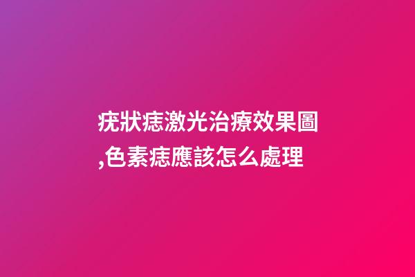 疣狀痣激光治療效果圖,色素痣應該怎么處理-第1張-觀點-玄機派
