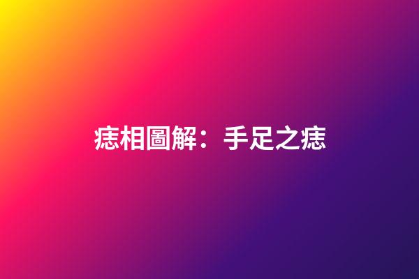 痣相圖解：手足之痣