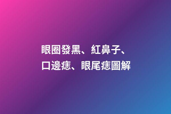 眼圈發黑、紅鼻子、口邊痣、眼尾痣圖解