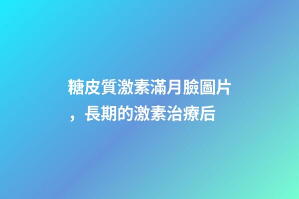 糖皮質激素滿月臉圖片，長期的激素治療后-第1張-觀點-玄機派