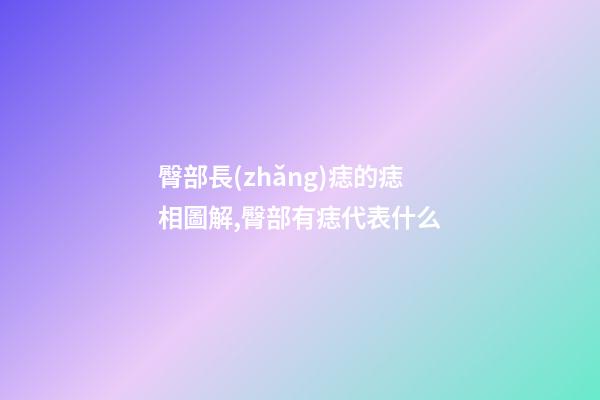 臀部長(zhǎng)痣的痣相圖解,臀部有痣代表什么