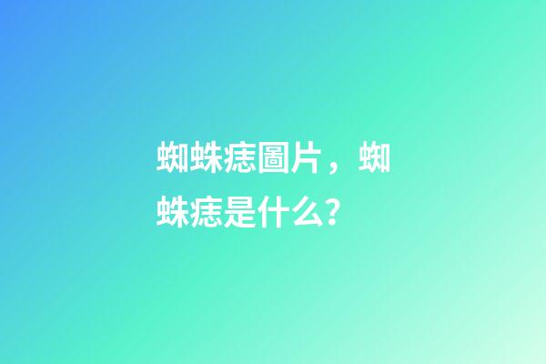 蜘蛛痣圖片，蜘蛛痣是什么？