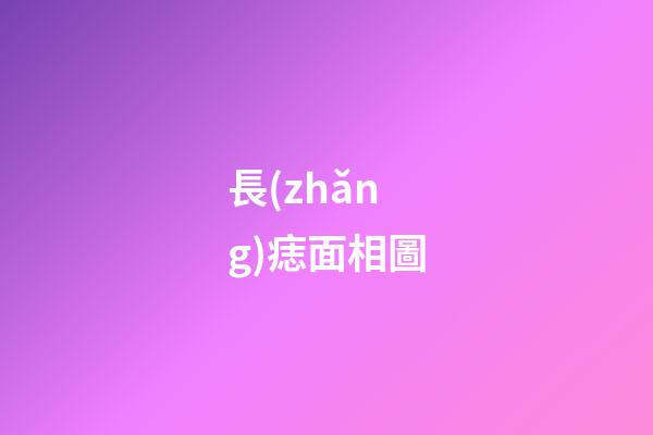 長(zhǎng)痣面相圖（男人面部痣好壞一覽表）