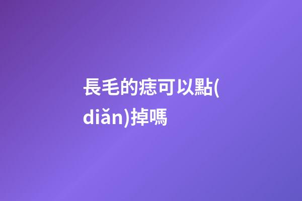 長毛的痣可以點(diǎn)掉嗎