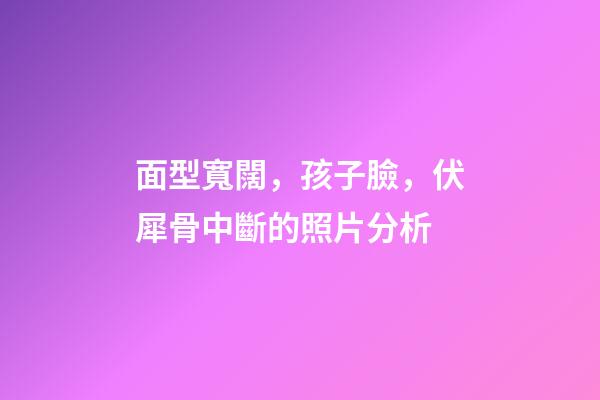 面型寬闊，孩子臉，伏犀骨中斷的照片分析