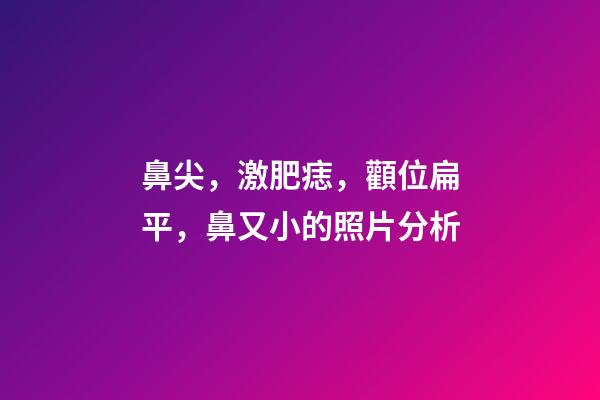 鼻尖，激肥痣，顴位扁平，鼻又小的照片分析